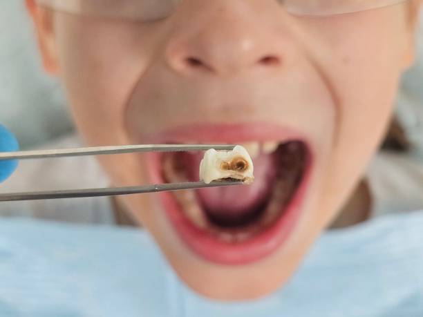 Best Emergency Pediatric Dental Care in Seattle, WA